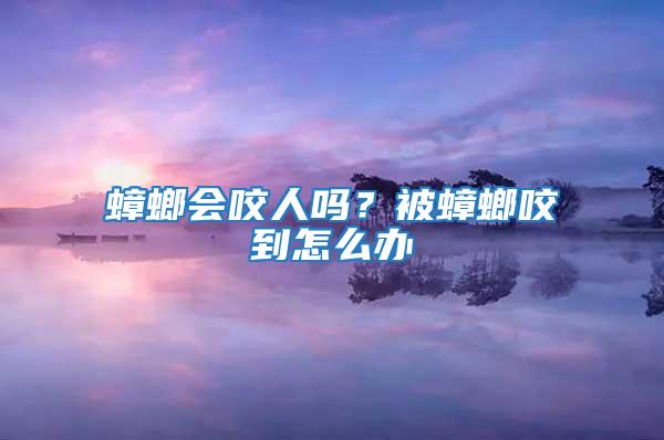 蟑螂會(huì)咬人嗎？被蟑螂咬到怎么辦