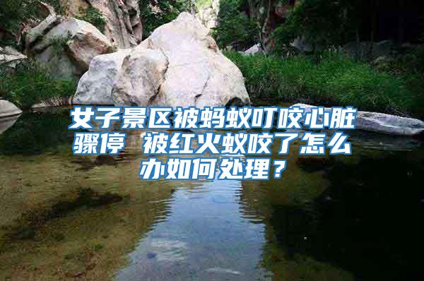 女子景區被螞蟻叮咬心臟驟停 被紅火蟻咬了怎么辦如何處理？